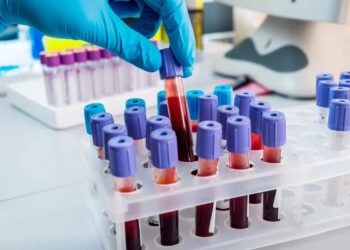 Simple blood check can predict a lady’s coronary heart illness threat a long time upfront