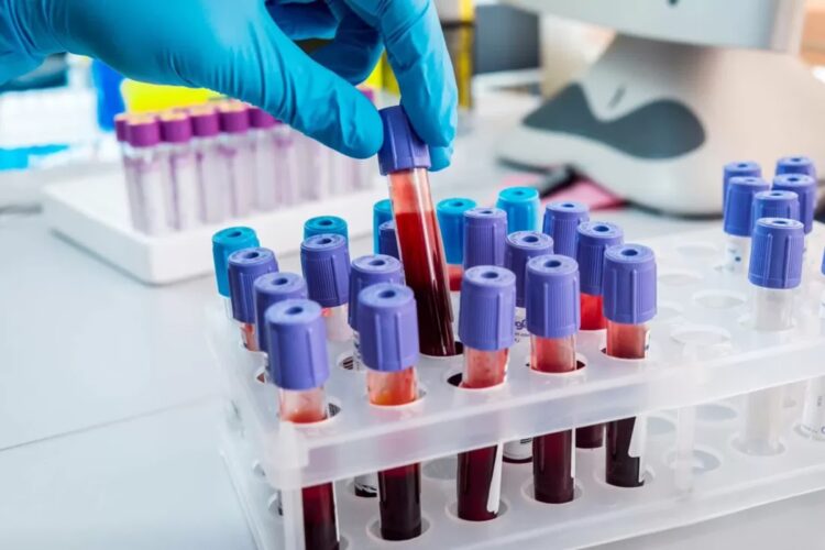 Simple blood check can predict a lady’s coronary heart illness threat a long time upfront